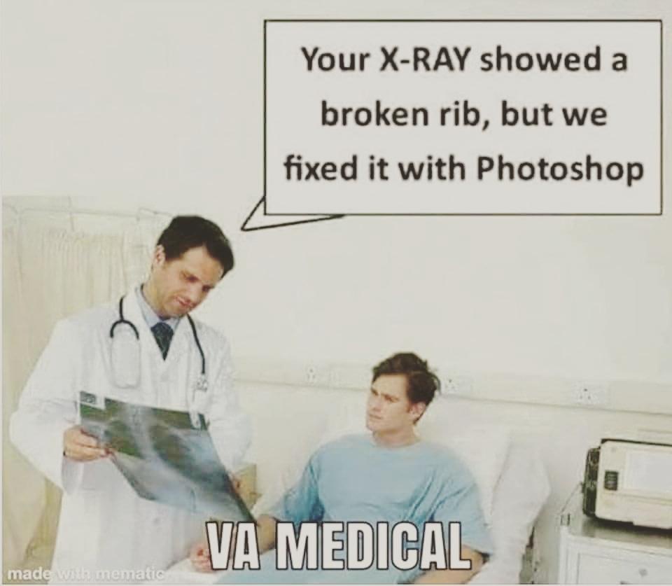 broken-rib.jpeg