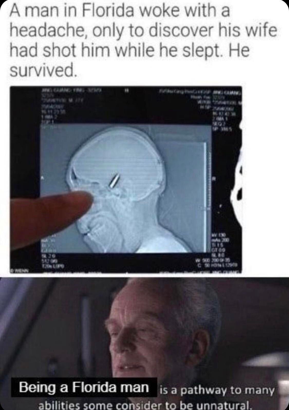 headache.jpeg