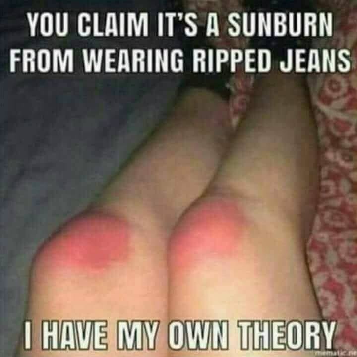 sun-burn.jpeg